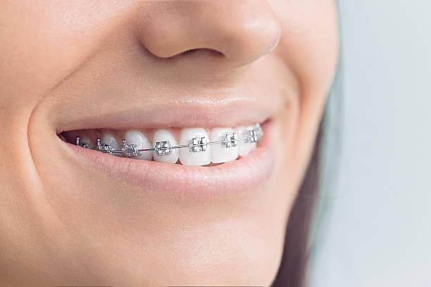 Best Dental Inlays and Onlays  in Georgetown, CA
